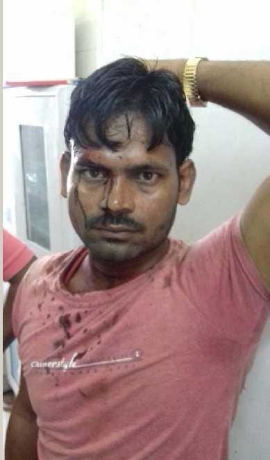 Youth's head boils down to Rs 270 dispute