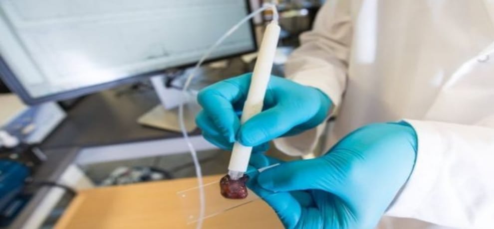What is Prostate Cancer, know all about it