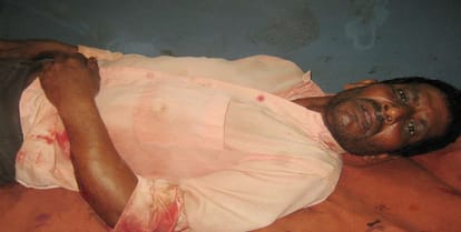 Bloody conflicts in Dalits and Thakurs, 18 people injured, police force deployed on spot