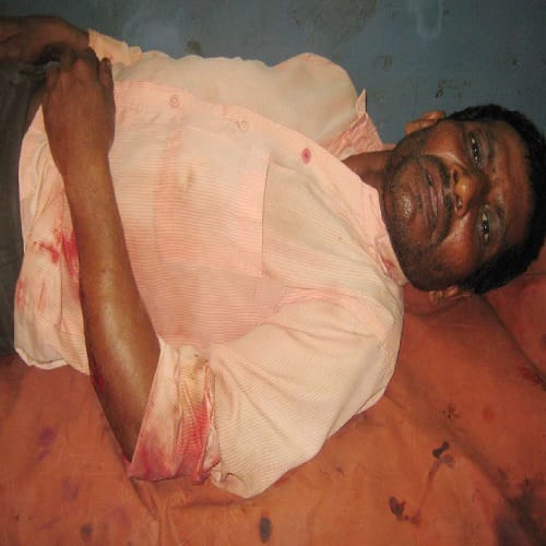 Bloody conflicts in Dalit and Thakur, about tampering, see photos