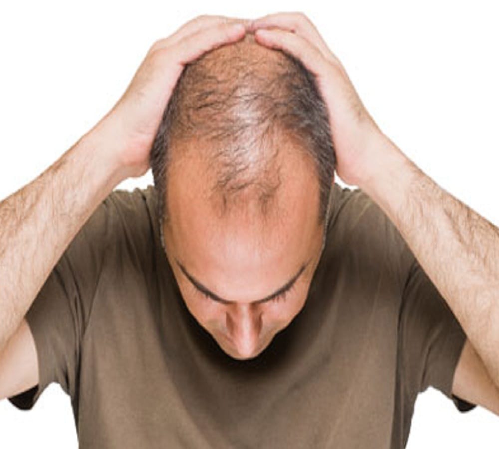 dont apply these things on hair it may increase your problems 