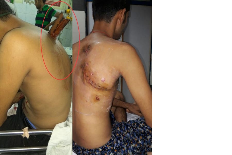 doctor's of KGMU saved the life of a man who met to an accident.