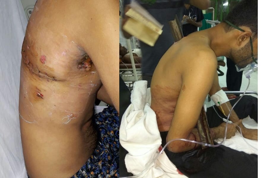 doctor's of KGMU saved the life of a man who met to an accident.