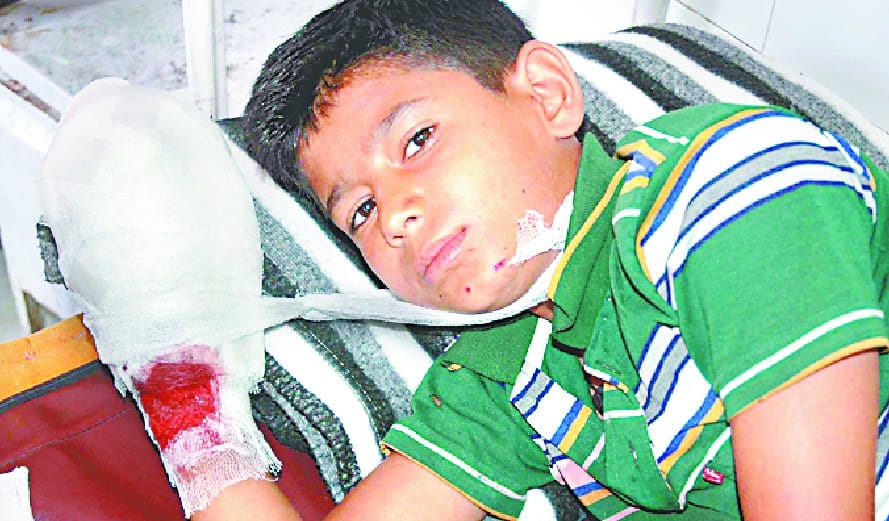 Mobile's battery broken, three fingers of teen's hands cut off