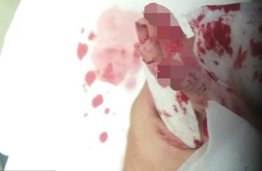 Rats ate disabled girl alive