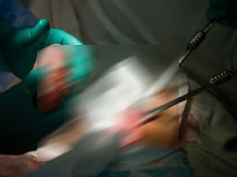 kidney racket expose in dehradun