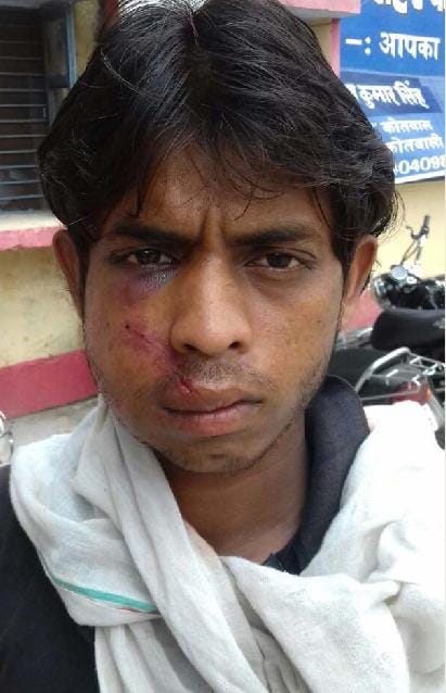 The beating of the young man when asked for lending money