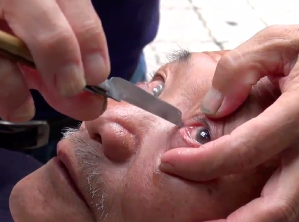 Watch how Man cleans eyes with Knife