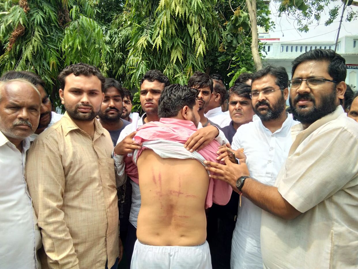 bjp leader beaten in agra by police