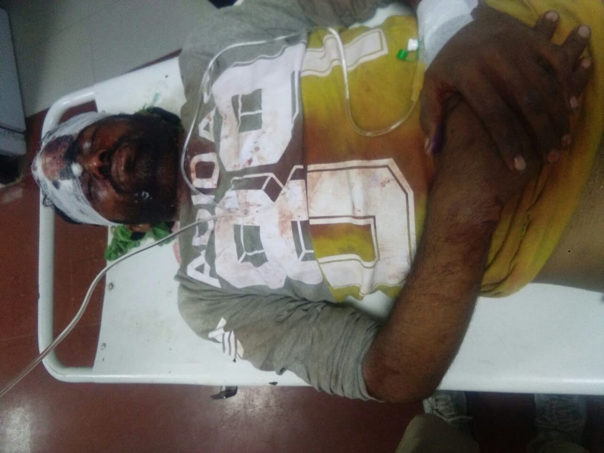 man in mainpuri shoot his fast friend for money