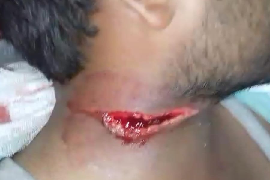 Chinese manjha cut the student neck