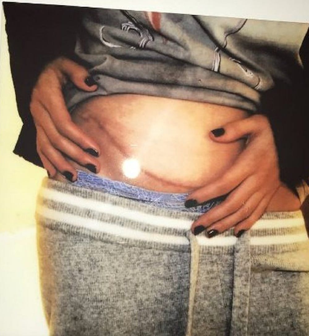 Selena Gomez reveals about her kidney transplant best friend was the donor