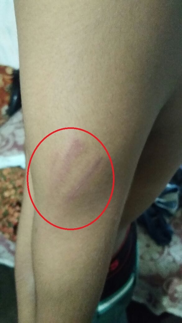 a 10th classs student badly beaten up by manager in a school of jodhpur 