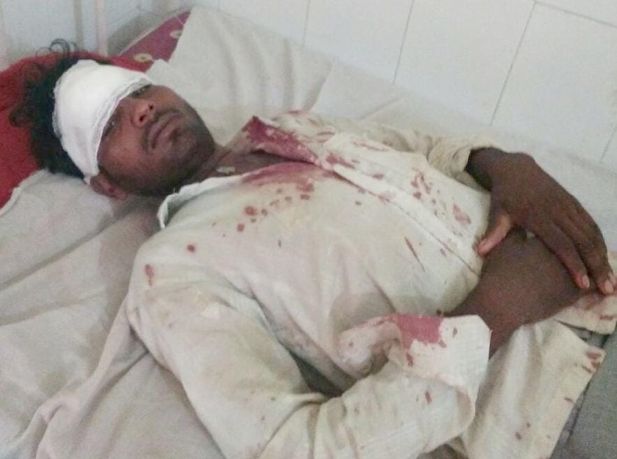 Angry with the beating of the young man, the villagers beat the sepoys