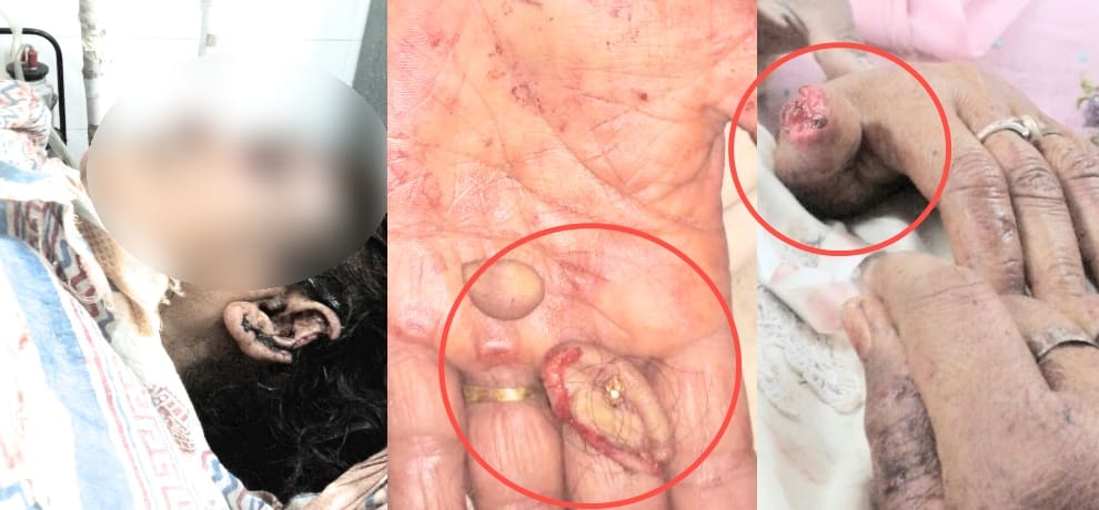 Himachal Solan widow woman tortured by brother