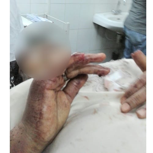 Himachal Solan widow woman tortured by brother