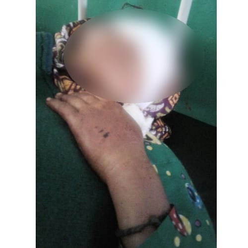 Himachal Solan widow woman tortured by brother