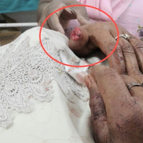 Himachal Solan widow woman tortured by brother