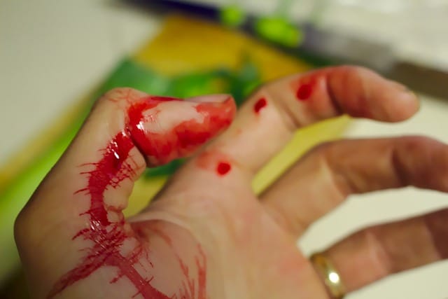 These Are Some Of The Most Unusual Phobias We have Ever Heard Of