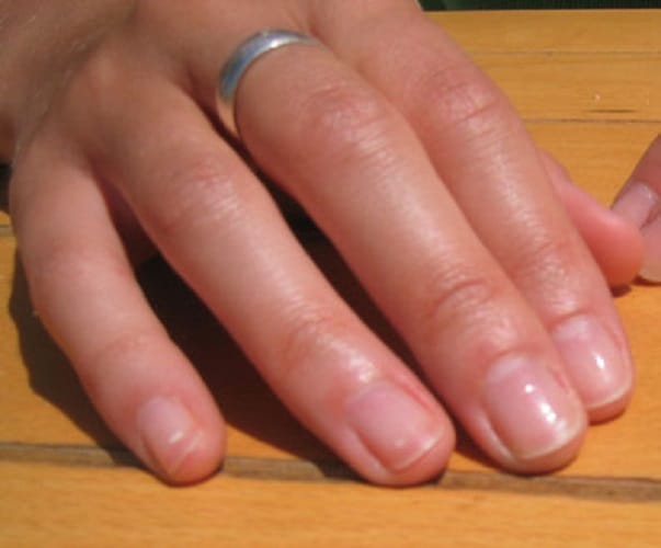 what does your fingers say about your health