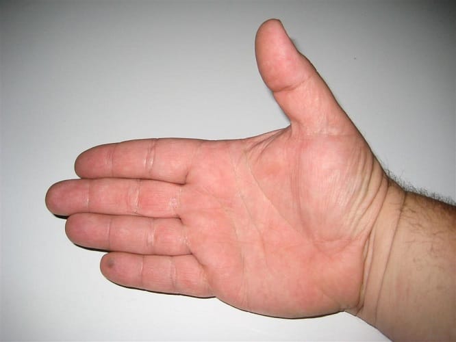 what does your fingers say about your health