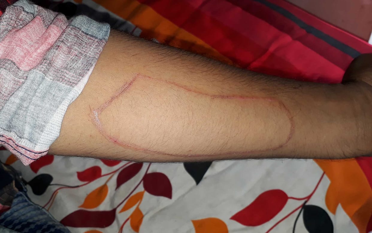 chandauli man is affected by online game blue whale