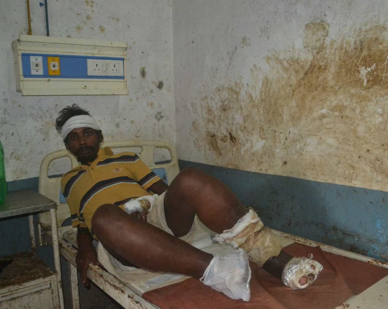 The patient left the stinking patient