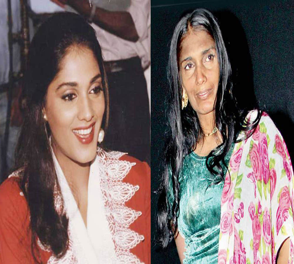 bollywood Actress who got brutally injured and lost Their career Anu Agarwal Sudha Chandran Zeenat Aman Sadhna