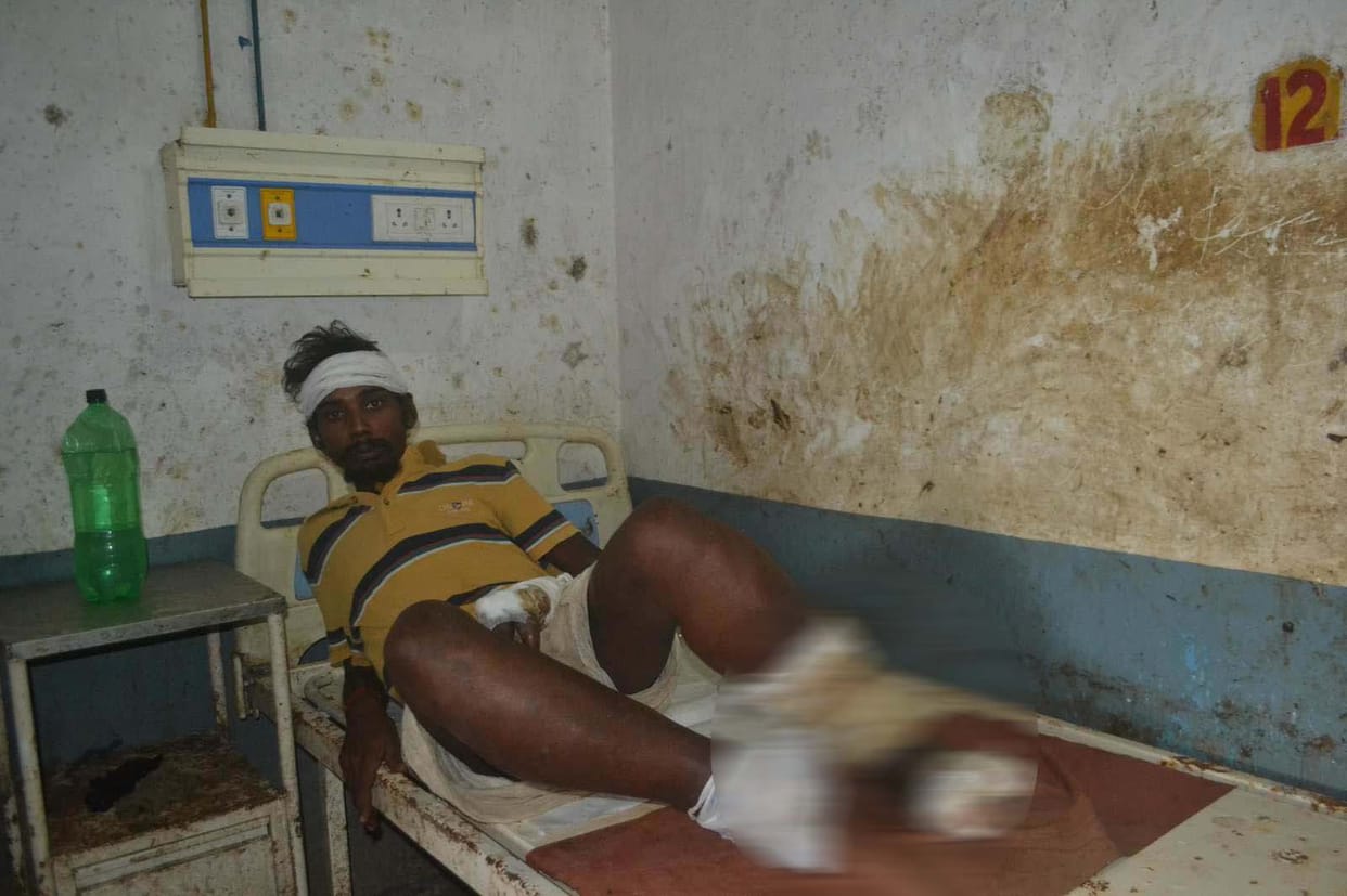 Azamagrh doctors do shameful work with patient
