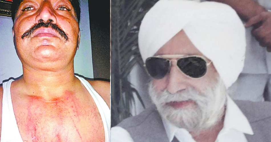 attack on beant singh murder case main witness