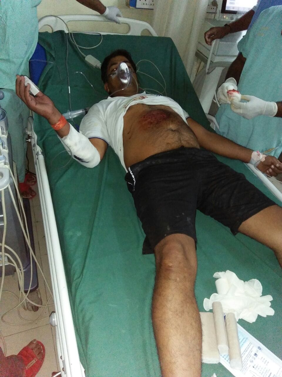 man in agra shoot his younger brother