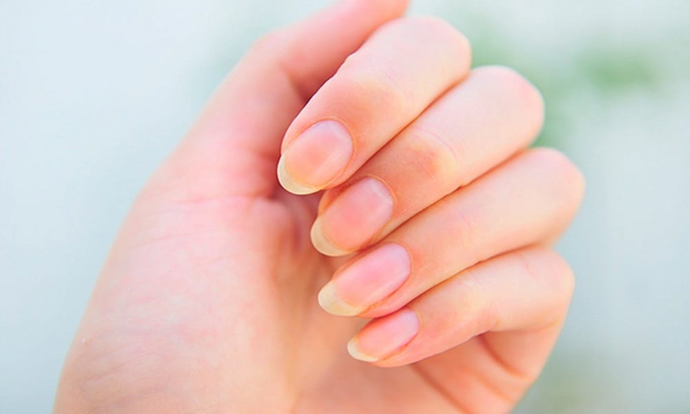 according to palmistry those person Such nails are made on finger is lucky