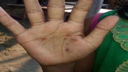 Warden punishes girls for allegedly mobile theft in Begusarai of Bihar