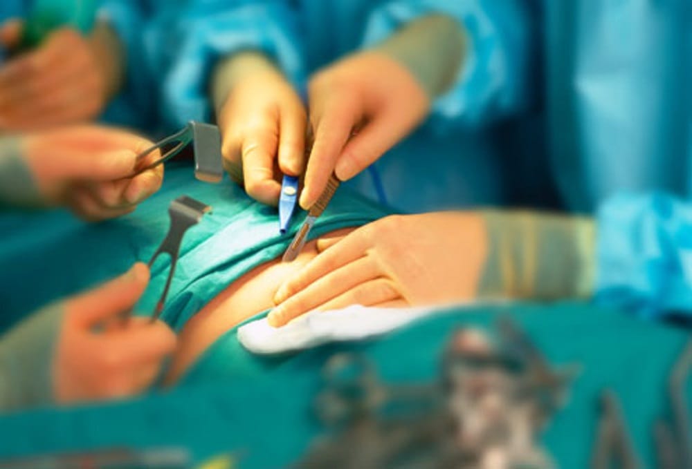 doctors opinion on giving rights for surgery to ayush doctors