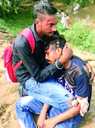 चालक को मिर्गी आने से बस पलटी, कई घायल