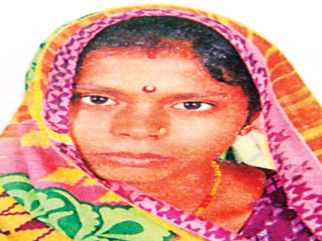 Burnt woman was killed by fire