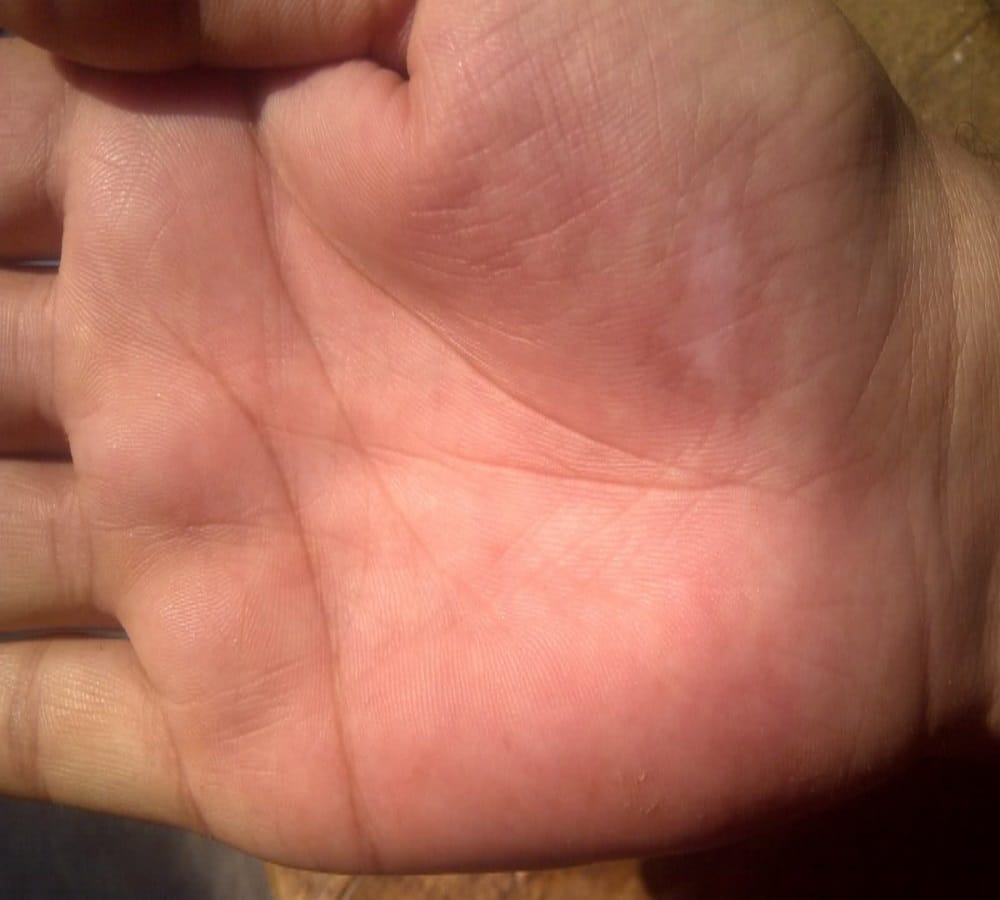 such people become millionaires, these lines and marks on hand