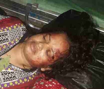 old lady killed and four injured during car fell in ditch in champawat
