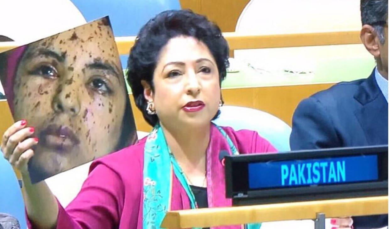 Pakistan said, Pallet guns used by India in Kashmir, more than 200 people lost eyes