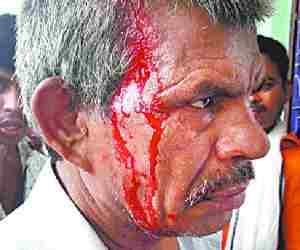 SDO attacks old men