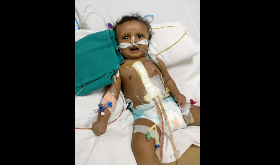 This doctor used a unique experiment on the child the body was completely blue