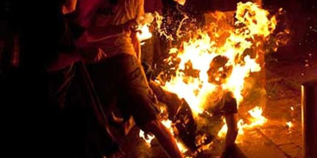 father and step brother burnt 