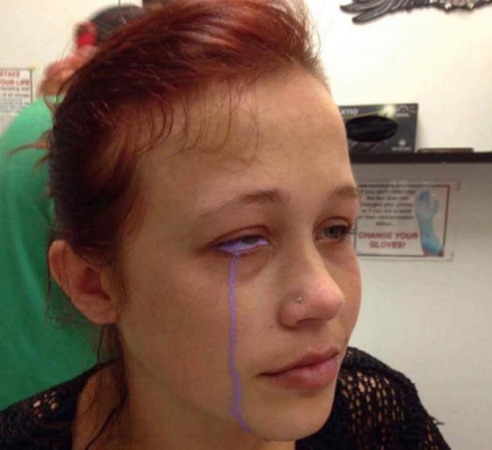 Canadian model eye tattoo goes horribly wrong she lost her one eye