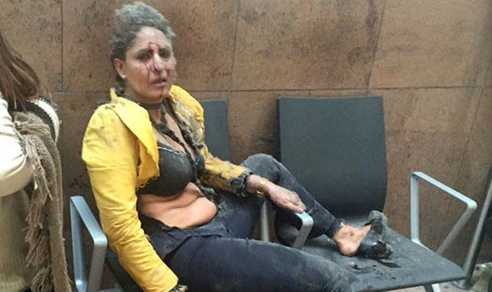  nidhi chaphekar wounded in the terrorist attack in Brussels now she is ready to fly