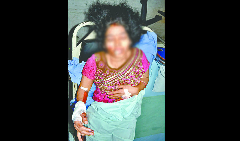 This bloody car ran on the road as death in ghaziabad