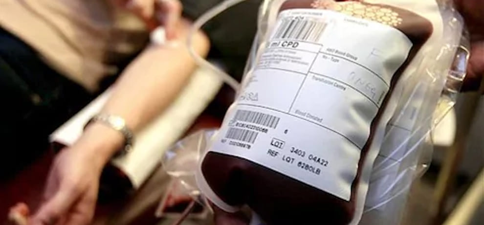 platelets donationa may be dangerous more than two times in week