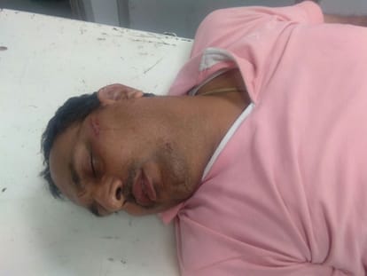 cm yogi security person attacked by goons