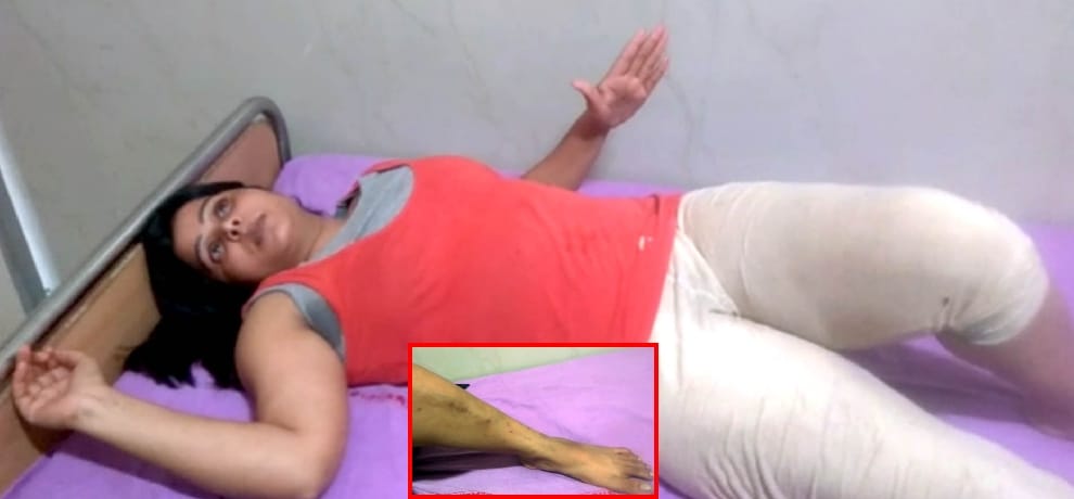 goons eve teased woman lawyer on dress after police complaint they beat her and daughter in home