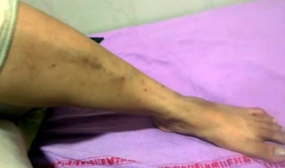 goons eve teased woman lawyer on dress after police complaint they beat her and daughter in home