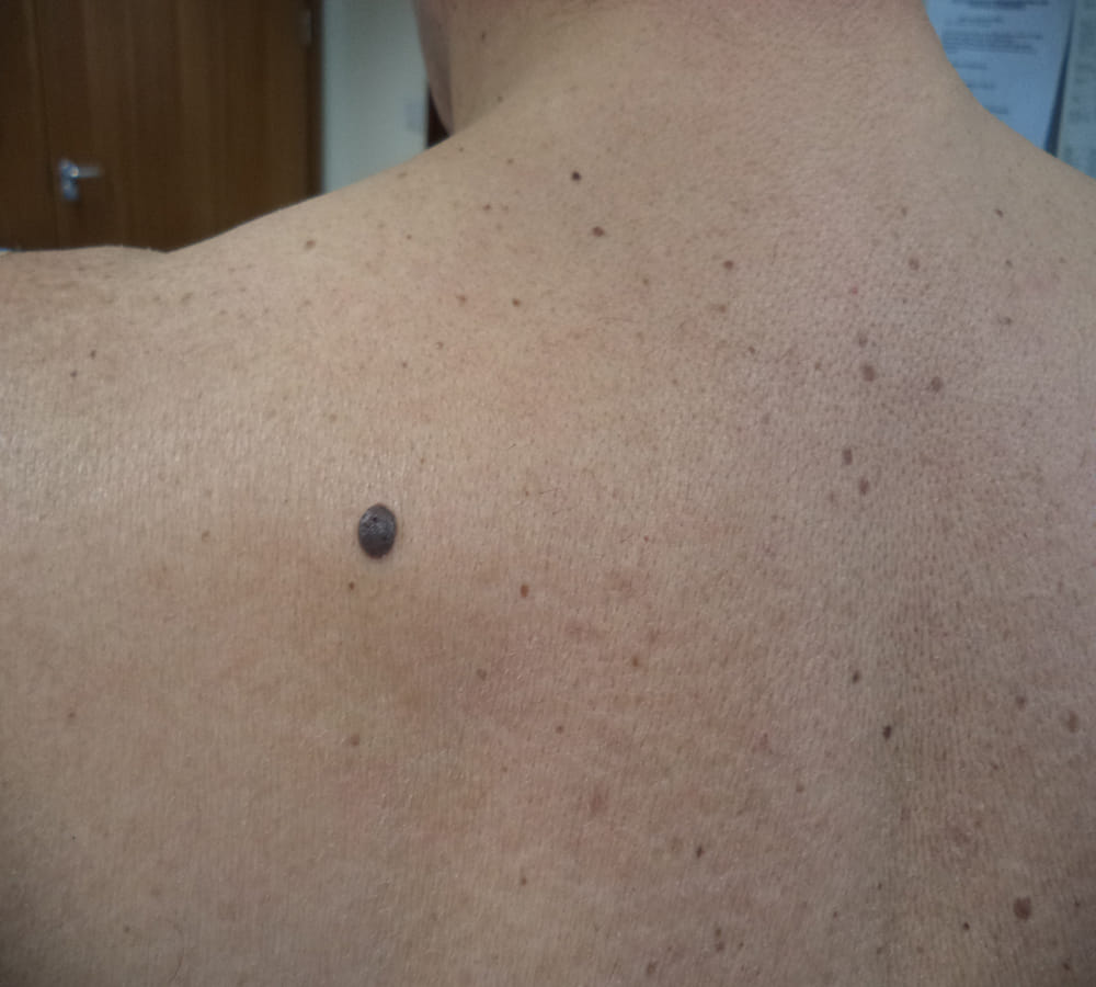 this moles can predict that you will always travel or not